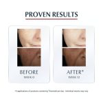 Eucerin Anti-Pigment Dual Serum 30ml – Visible Results in 2 Weeks - Image 6