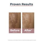 Eucerin Anti-Pigment Dual Serum 30ml – Visible Results in 2 Weeks - Image 9