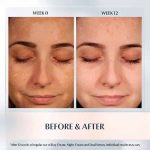 eucerin dual serum anti pigment example