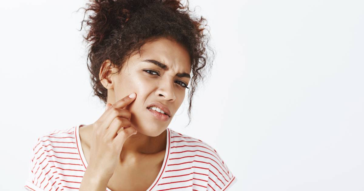 Fade Dark Spots and Hyperpigmentation