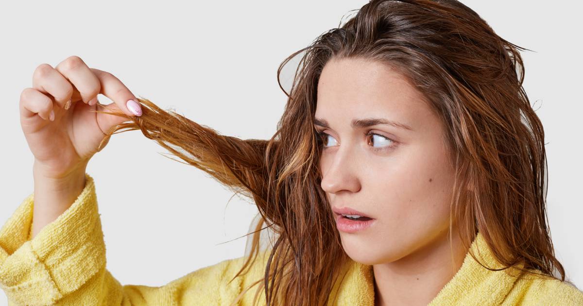 All You Need to Know About Hair Loss