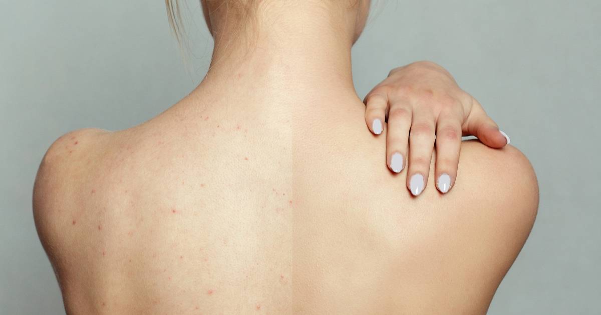 Woman applying skincare to her back
