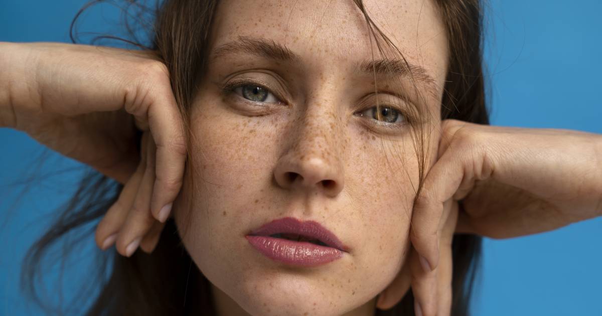 Sunspots Treatment