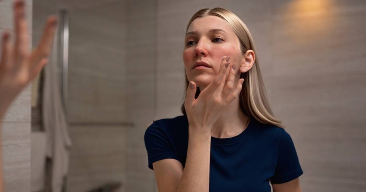 Skincare treatment for facial atopic dermatitis