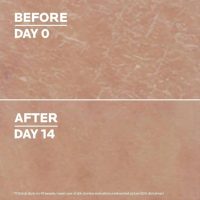 Buy Pele Atópica do Bebé Online - Idivia Beauty Shop
