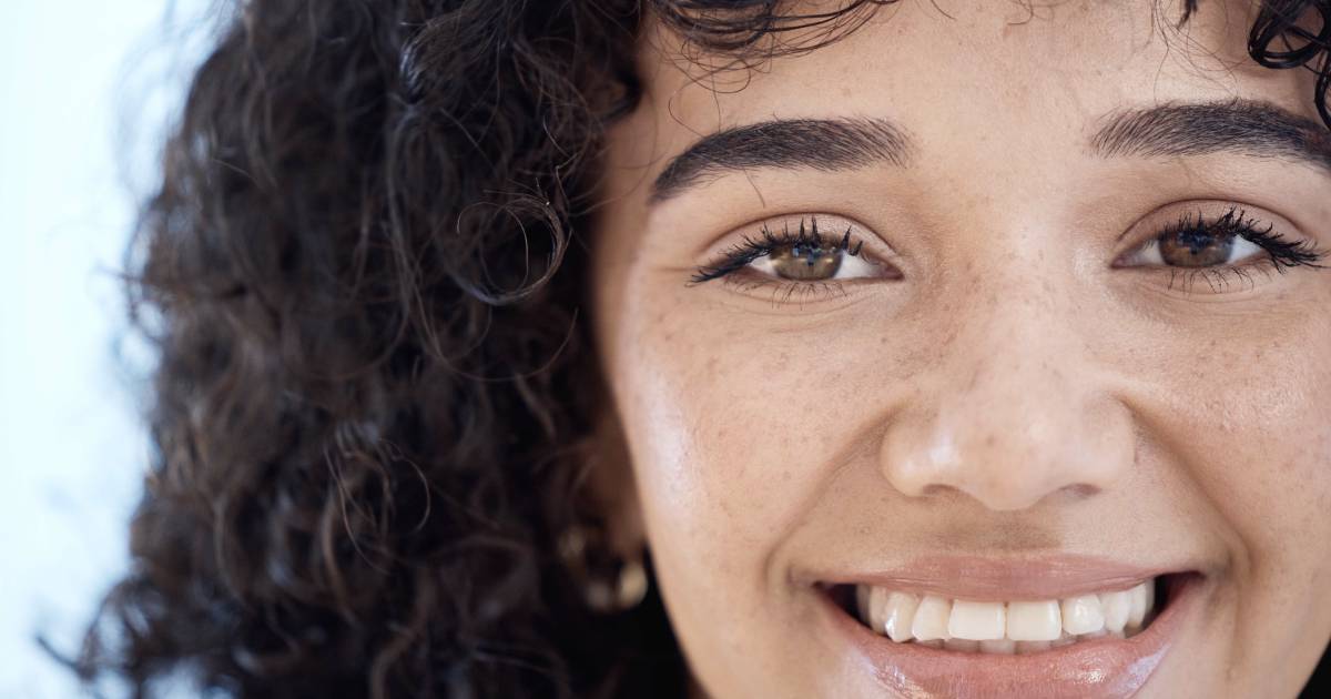 Close-up of skin with post-summer dark spots and hyperpigmentation
